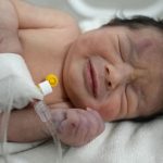 Bebé que nació en medio de los escombros del terremoto en Siria es la única sobreviviente de su familia